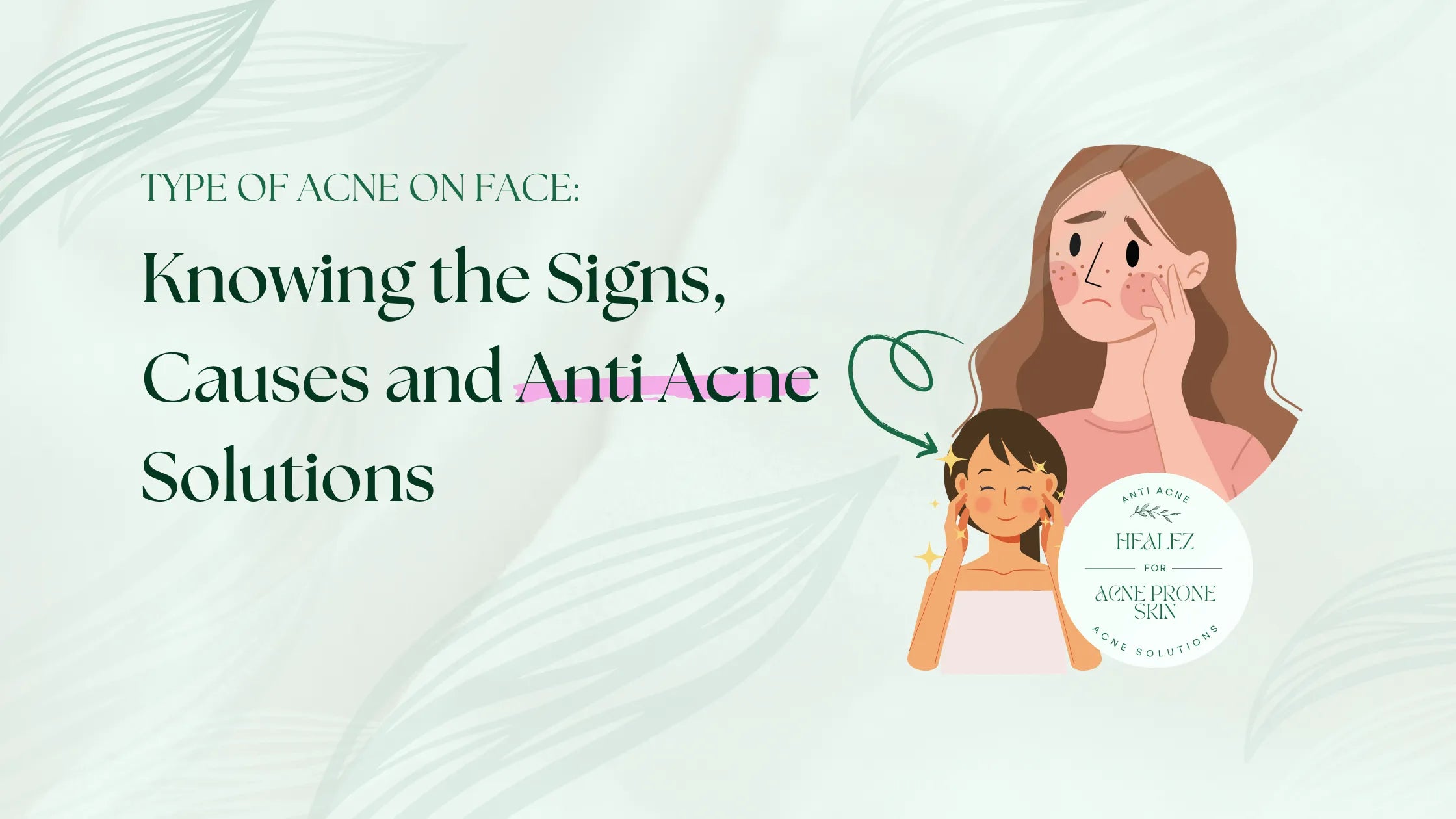 Type of Acne on Face: Knowing the Signs, Causes and Anti Acne Solutions