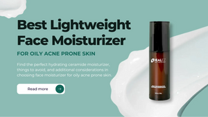 Best Lightweight Face Moisturizer That Works Wonder for Oily Acne Prone Skin