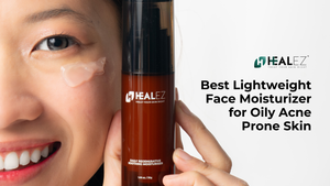 Best Lightweight Face Moisturizer That Works Wonder for Oily Acne Prone Skin